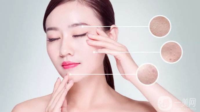 激光祛痘果怎么樣 激光祛痘好不好