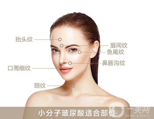 上海瑞蘭玻尿酸價格？果怎么樣？