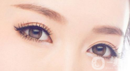 生物焊接雙眼皮多少錢？果怎么樣？