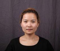 上海華美李志海下頜角整形多少錢？案例圖片實記~