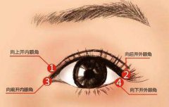上海韓式開(kāi)內(nèi)眼角多少錢(qián)