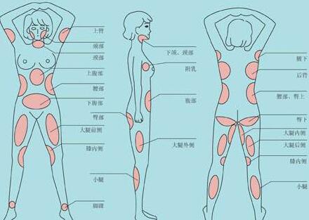 南京吸脂減肥價(jià)格是多少？