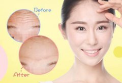 抬頭紋怎么調(diào)節(jié)？調(diào)節(jié)抬頭紋方法有哪些？