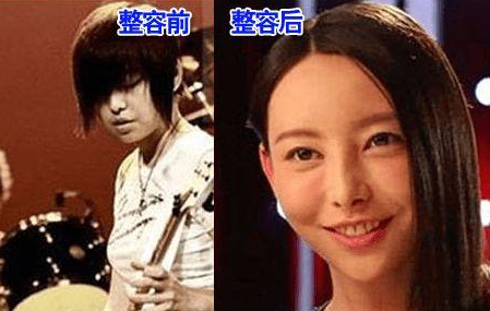 于文文整容了嗎？于文文整容前后圖