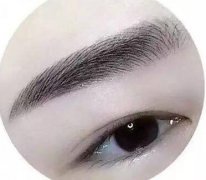 種植眉毛調(diào)節(jié)眉毛缺損手術(shù)是什么？