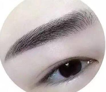 種植眉毛調(diào)節(jié)眉毛缺損手術(shù)是什么？