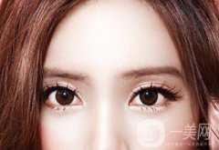 割雙眼皮價(jià)格是多少錢？收費(fèi)明細(xì)~