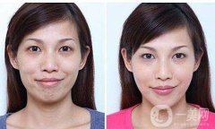 熱瑪吉果好嗎？熱瑪吉除皺果怎么樣？