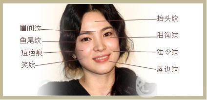 雙美膠原蛋白隆鼻怎么樣?*果能維持多久？