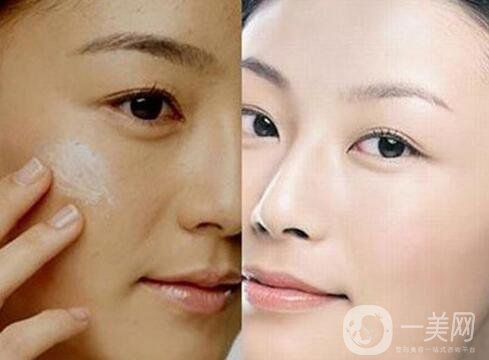 彩光嫩膚要多少錢？彩光嫩膚價(jià)格需要多少？