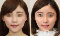 *大概要多少錢、*的費(fèi)用詳解