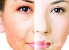 光子嫩膚的果如何、光子嫩膚到底怎么樣？