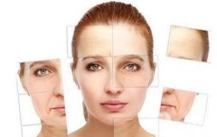 祛皺多少錢 去皺價(jià)格一般是多少