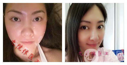 上海九院整形好嗎 上海九院各大整形案例詳解_坐診專家