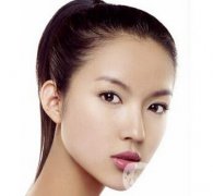 *隆鼻價(jià)格 *隆鼻需要多少錢(qián)