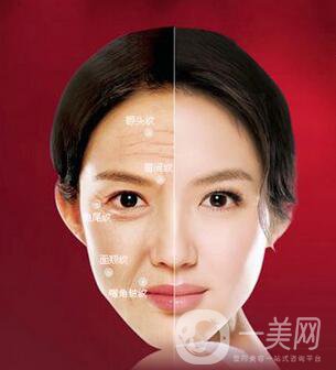 黑臉娃娃做幾次*果？黑臉娃娃*果總結(jié)~