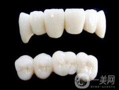 各種烤瓷牙的價(jià)格 烤瓷牙多少錢(qián)