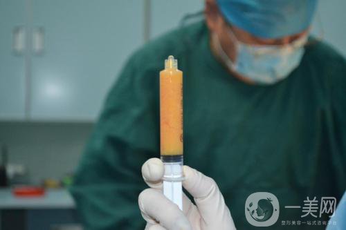 抽脂形體改良怎么做才能恢復(fù)好？