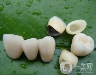 做完烤瓷牙可以使用多少年？