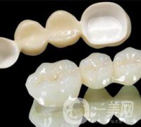 做普通烤瓷牙一般需要多少錢？