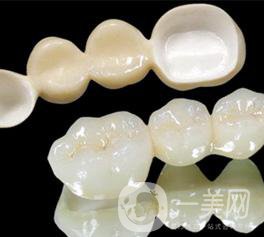 美容冠多少錢 價(jià)格詳情介紹