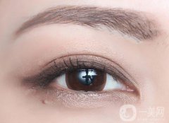 什么是高分子雙眼皮 價格多少錢？