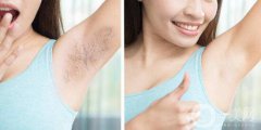 激光脫毛后還會(huì)長嗎 激光脫毛是*的嗎