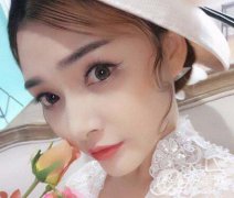 上海假體墊鼻梁多少錢 價格是多少