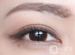 上海割雙眼皮要多少錢 上海割雙眼皮價格