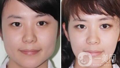 **多少錢 **價(jià)格詳解