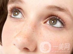 黃褐斑怎么形成的 怎么去除？