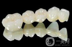 一個(gè)烤瓷牙多少錢(qián) 價(jià)格貴嗎？