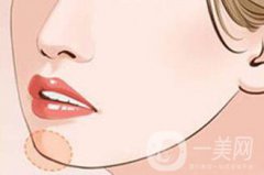 硅膠隆下巴價(jià)格 硅膠隆下巴多少錢