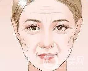 為什么會長老年斑，和哪些因素有關？