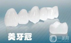 美容冠多少錢一顆 美容冠一顆的價錢是多少