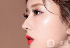 上海鼻梁骨矯正手術(shù)費(fèi)用 價(jià)格盤點(diǎn)