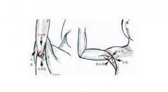 副乳的*佳切除時(shí)間 什么時(shí)候適合做副乳切除