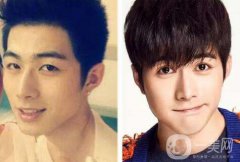 男生割雙眼皮會(huì)變帥嗎？