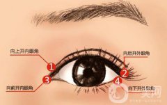 什么人適合做開眼角手術(shù)？