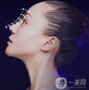 耳軟骨墊鼻梁維持多久 保持多久