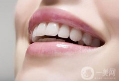 非金屬烤瓷牙價格一般是多少？