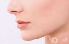 廣東鼻骨矯正術大概多少錢 廣東鼻骨矯正術價格分析