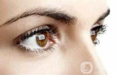 玻尿酸去黑眼圈術后護理 玻尿酸去黑眼圈術后注意事項