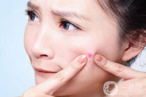 像素激光祛痘疤費用一般要多少錢？