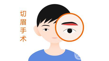 上海一般切眉需要多少錢 價格分析參考