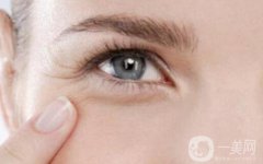 怎么去除表情紋 去除表情紋的方法