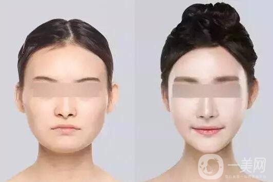 *,多少錢