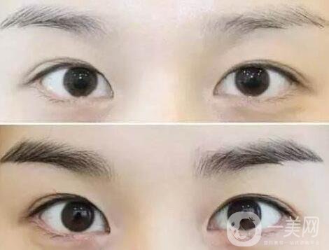 繡眉