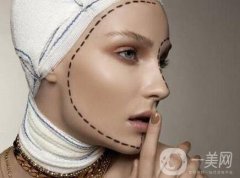 面部磨骨手術(shù)價格 面部磨骨手術(shù)多少錢