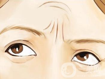 抬頭紋怎么治 去抬頭紋方法一覽
